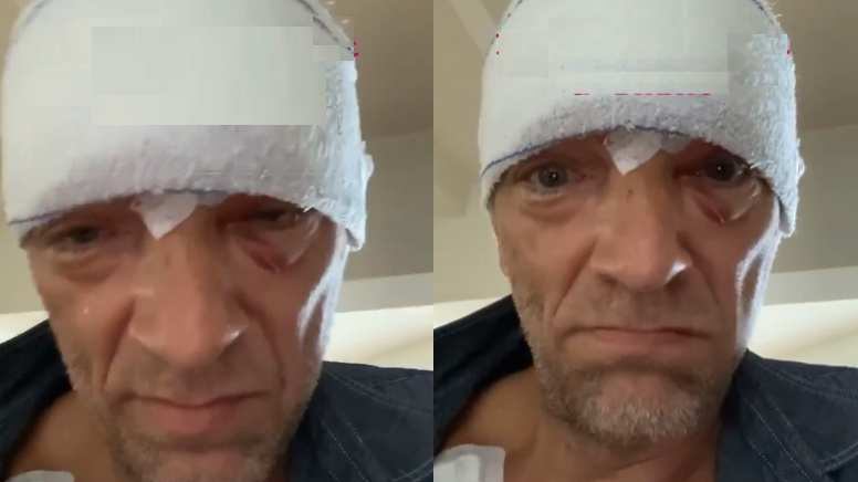 Paura per Vincent Cassel: un brutto incidente gli provoca un trauma cranico