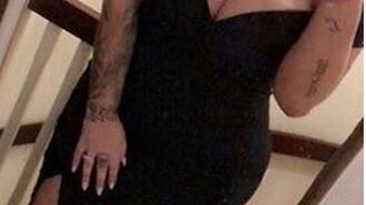 "L'acqua bollente ha sciolto il mio seno rifatto": il racconto choc della modella