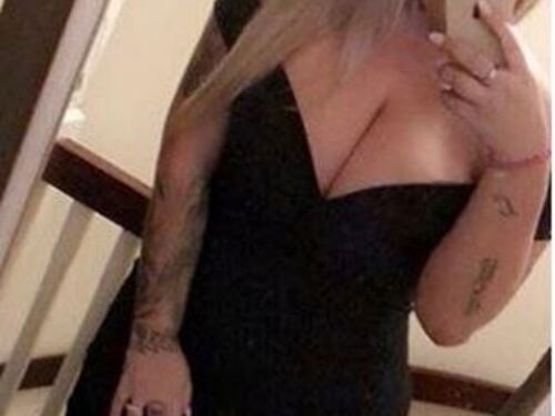 "L'acqua bollente ha sciolto il mio seno rifatto": il racconto choc della modella