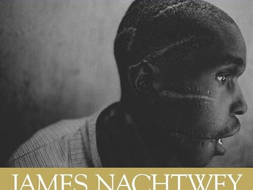 A Palazzo Reale la fotografia di James Nachtwey contro la guerra