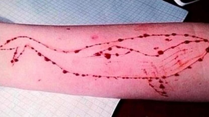 Pescara, 15enne con segni sul braccio: "Caso Blue Whale"