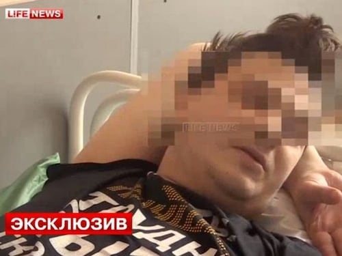 Mosca, ragazza lo droga in un bar, si sveglia il giorno dopo senza i testicoli