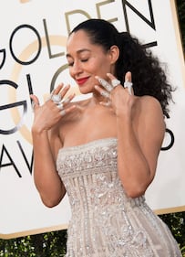 Golden Globe 2017: il red carpet si fa hot 31