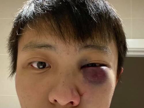 Gran Bretagna, studente asiatico pestato per il coronavirus: ma il movente è razziale