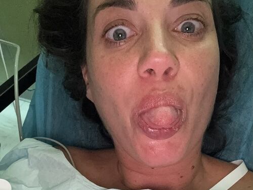 "Il giorno più brutto della mia vita". Il racconto di Eleonora Boi dopo l'attacco dello squalo
