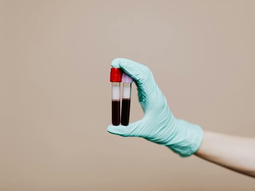 Anemia perniciosa, attenzione a questi sintomi