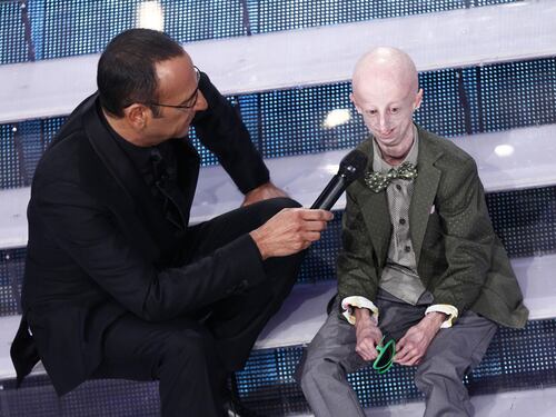La sindrome dei "nati vecchi". Cos'è la progeria, la malattia rara di Sammy Basso