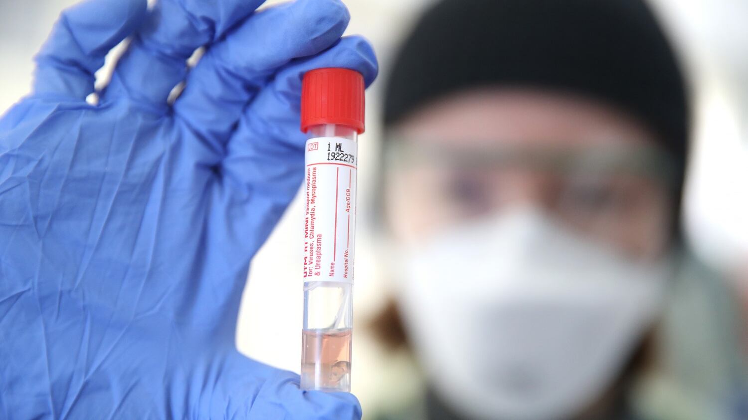 Ecco i test di massa sugli anticorpi: si scoprirà chi ha avuto il virus