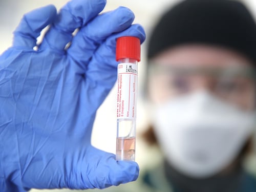 Ecco i test di massa sugli anticorpi: si scoprirà chi ha avuto il virus