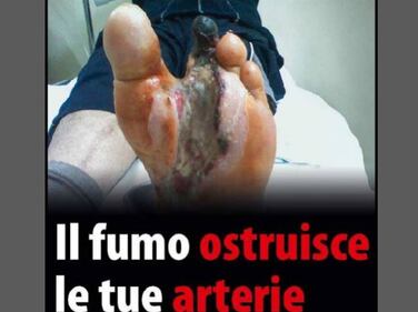 Le foto choc sui pacchetti di sigarette 9