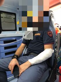 Milano, si dà fuoco in strada: le foto degli agenti feriti 4