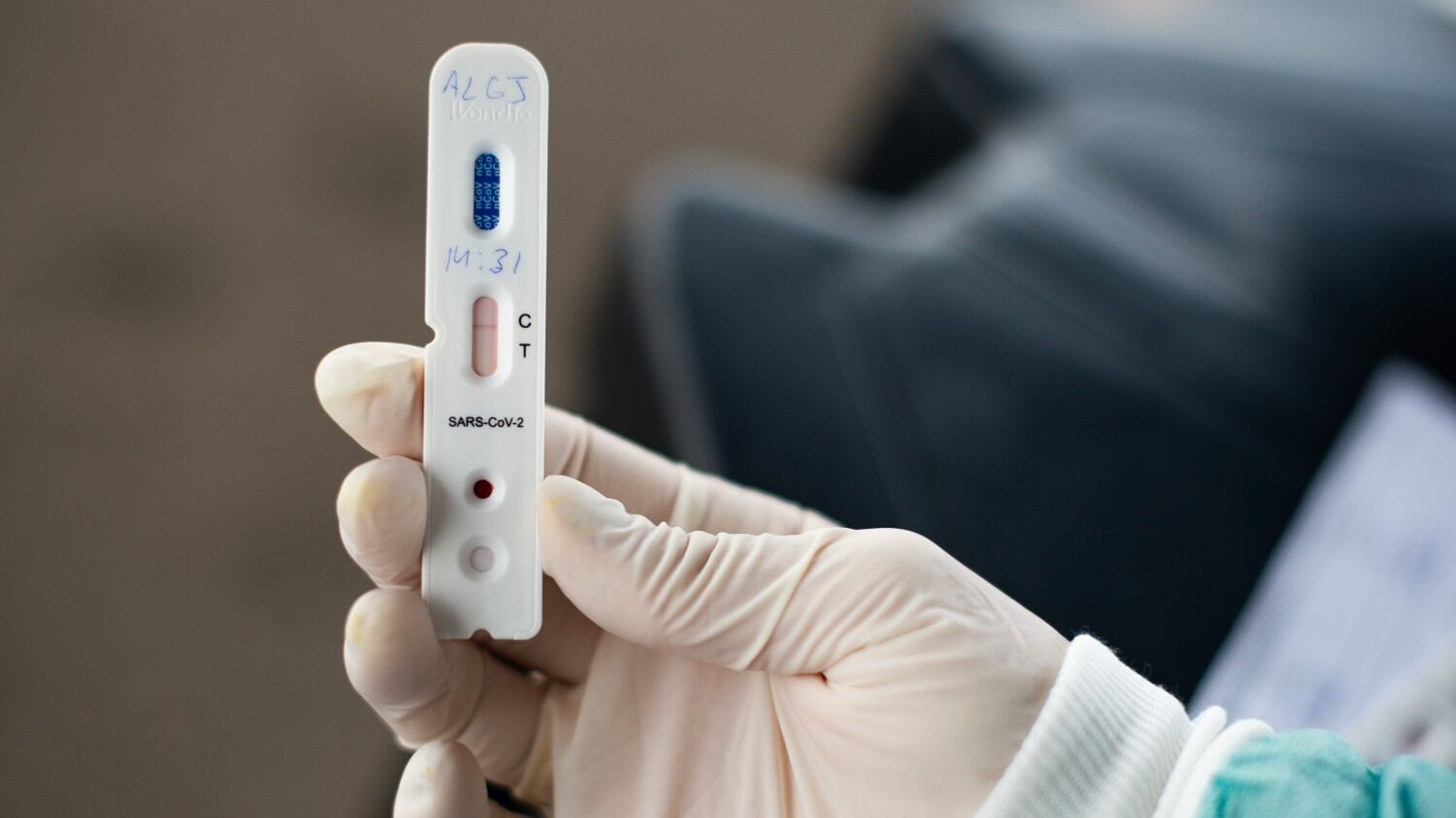 I test sierologici non partono. Manca un ok per usare i dati