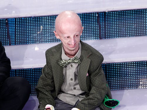 Malore al ristorante: morto a 28 anni Sammy Basso. Fece conoscere all'Italia la progeria