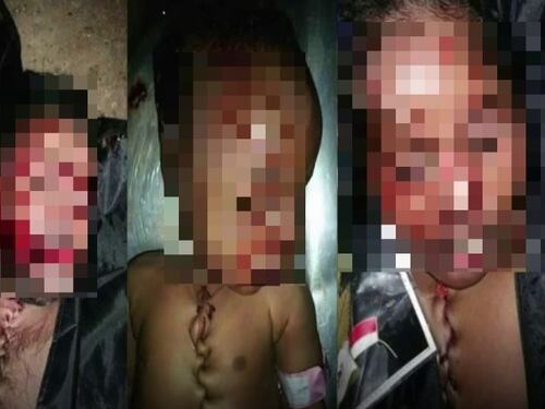 I cadaveri dei bimbi "ricuciti": l'orrore dei trafficanti di migranti