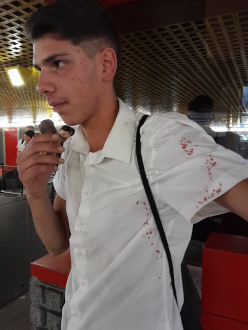 Ragazzo pestato a sangue in metropolitana dalle guardie del corpo di una borseggiatrice 1