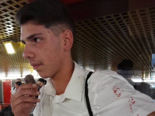 Pestato a sangue in metropolitana dalle "guardie del corpo" di una borseggiatrice