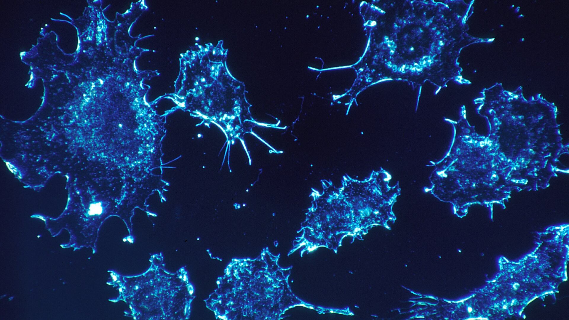 Tumori, trovato il codice di autodistruzione delle cellule