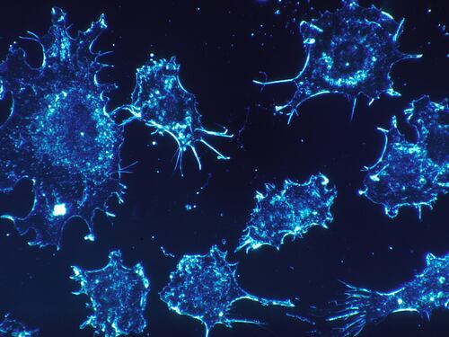 Scoperto l'interruttore che spegne il sistema immunitario favorendo il tumore