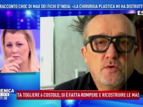 Max dei Fichi d'India: "Vita distrutta dalla chirurgia"