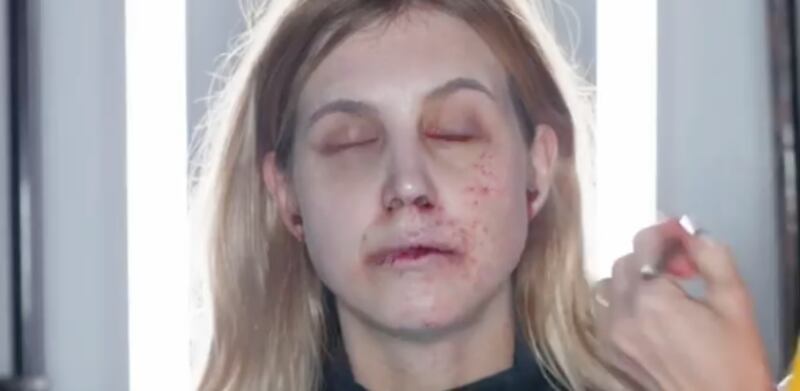 Modelle come malate di Ebola: la campagna choc delle ong olandesi 8