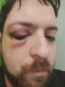 Matthia Pezzoni aggredito dalle borseggiatrici in metropolitana 1