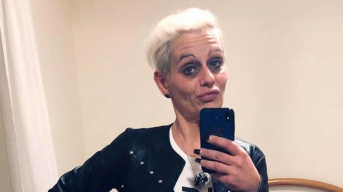 Stalkerizzato e sfregiato con l'acido ma per i giudici non c'è premeditazione
