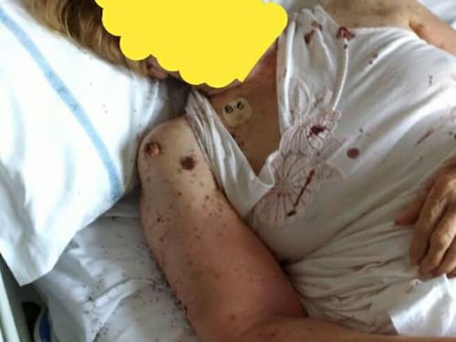 Napoli, le formiche in ospedale: 17 gli indagati
