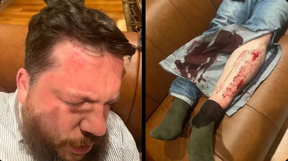 Volkov preso a martellate, la lunga mano di Mosca