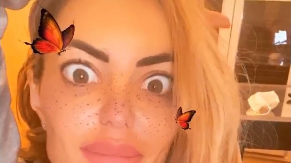 Elena Morali fuori controllo: "Ecco perché si usa l'acido ialuronico proprio lì"