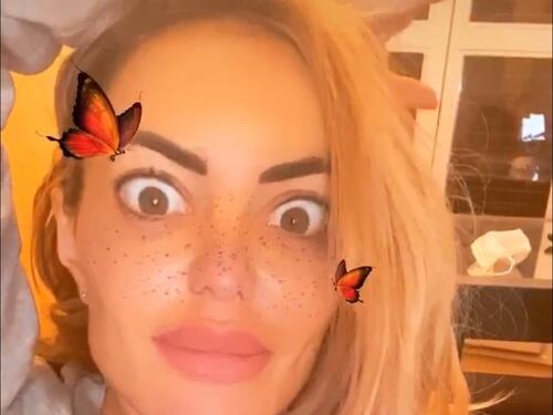 Elena Morali fuori controllo: "Ecco perché si usa l'acido ialuronico proprio lì"