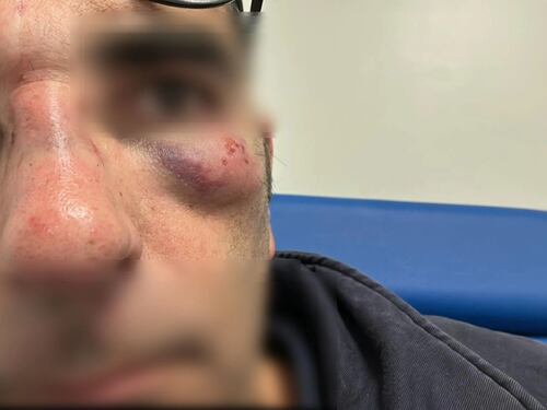 Non ha il biglietto e massacra di botte un esponente di FdI: fermato uno straniero