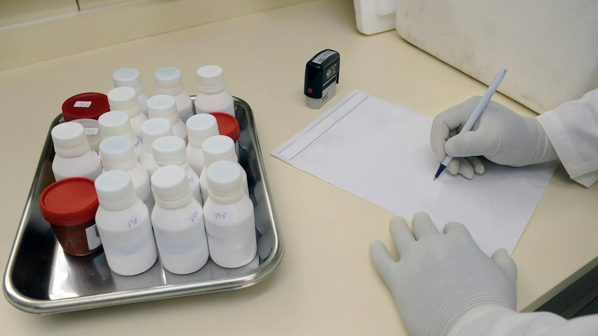 Alzheimer, nuovo test scopre la malattia nel 90% dei casi