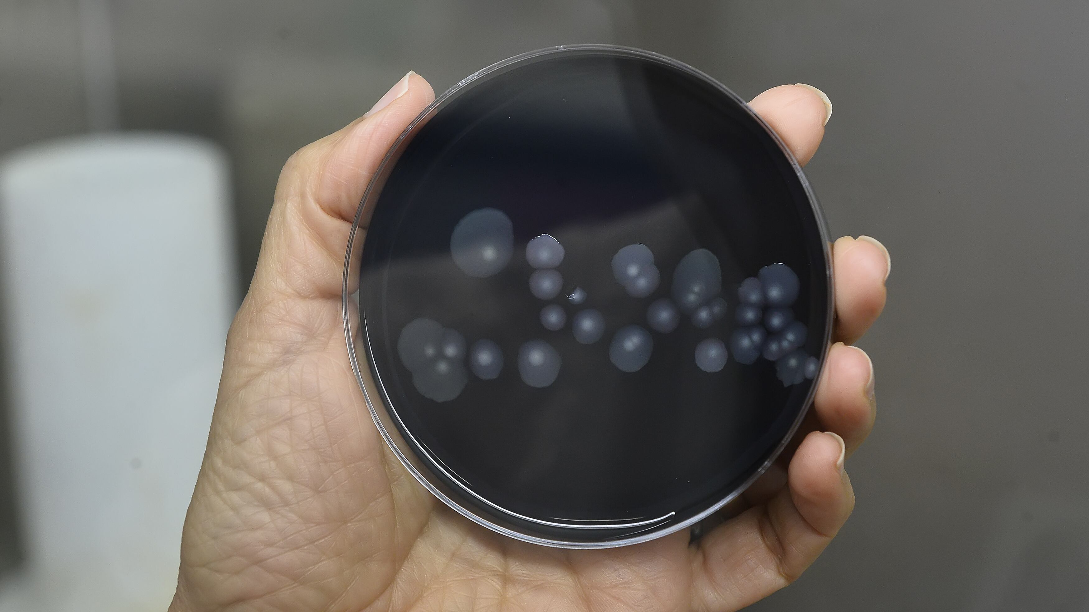Legionella, undici casi tutti in palazzi diversi