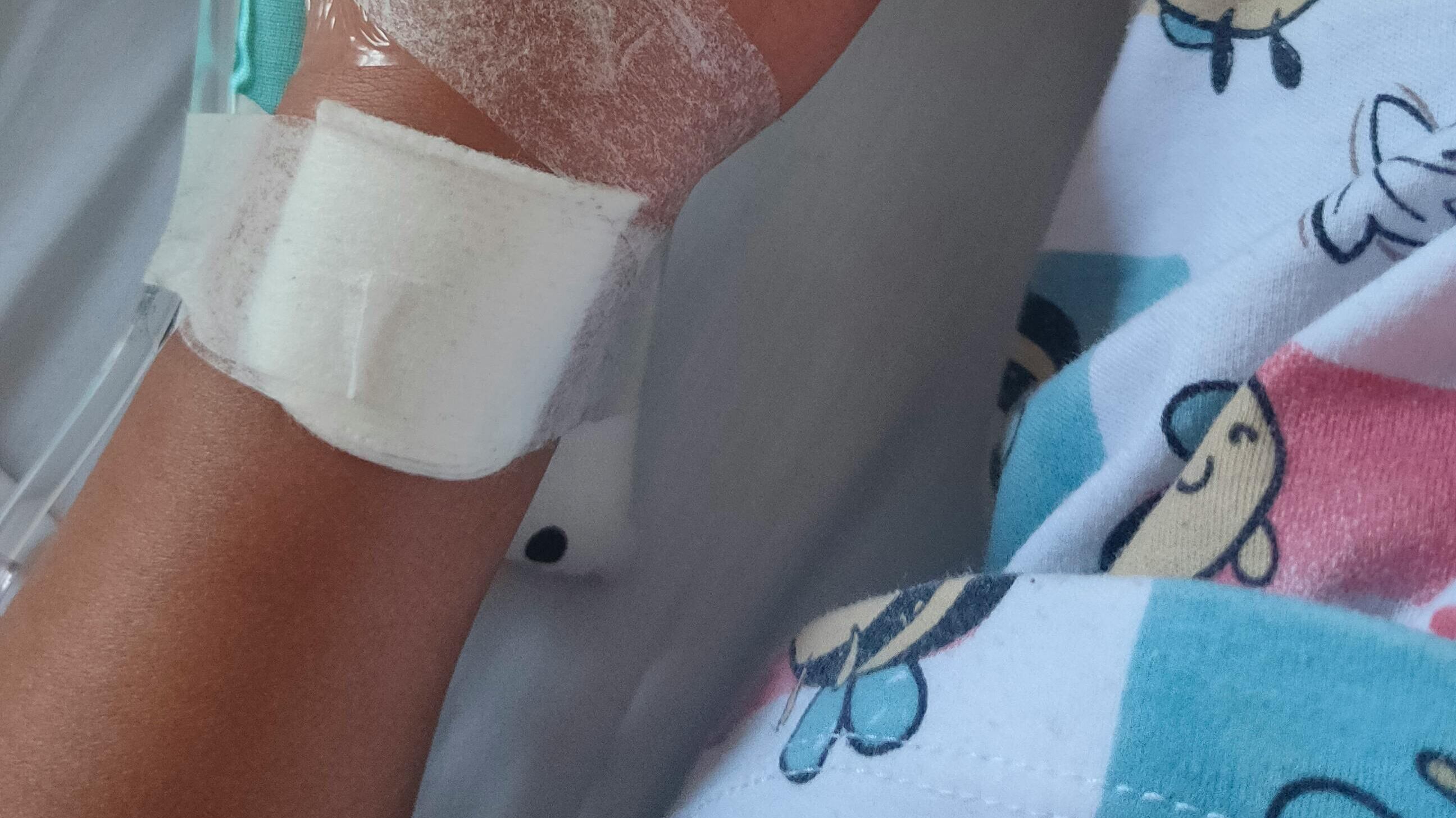 A 3 anni viene risucchiata nella vasca idromassaggio. Ora è grave in ospedale