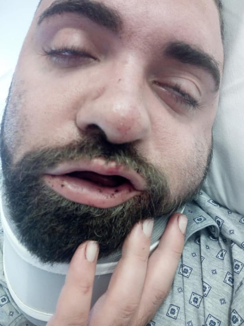 Taranto, le immagini dell'uomo in ospedale dopo l'aggressione 1