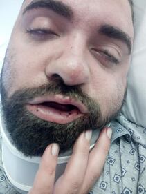 Taranto, le immagini dell'uomo in ospedale dopo l'aggressione 1