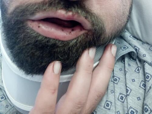 Taranto, le immagini dell'uomo in ospedale dopo l'aggressione
