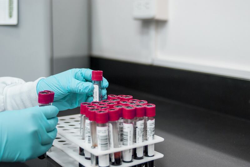 Cancro alla gola, un esame del sangue può prevederlo