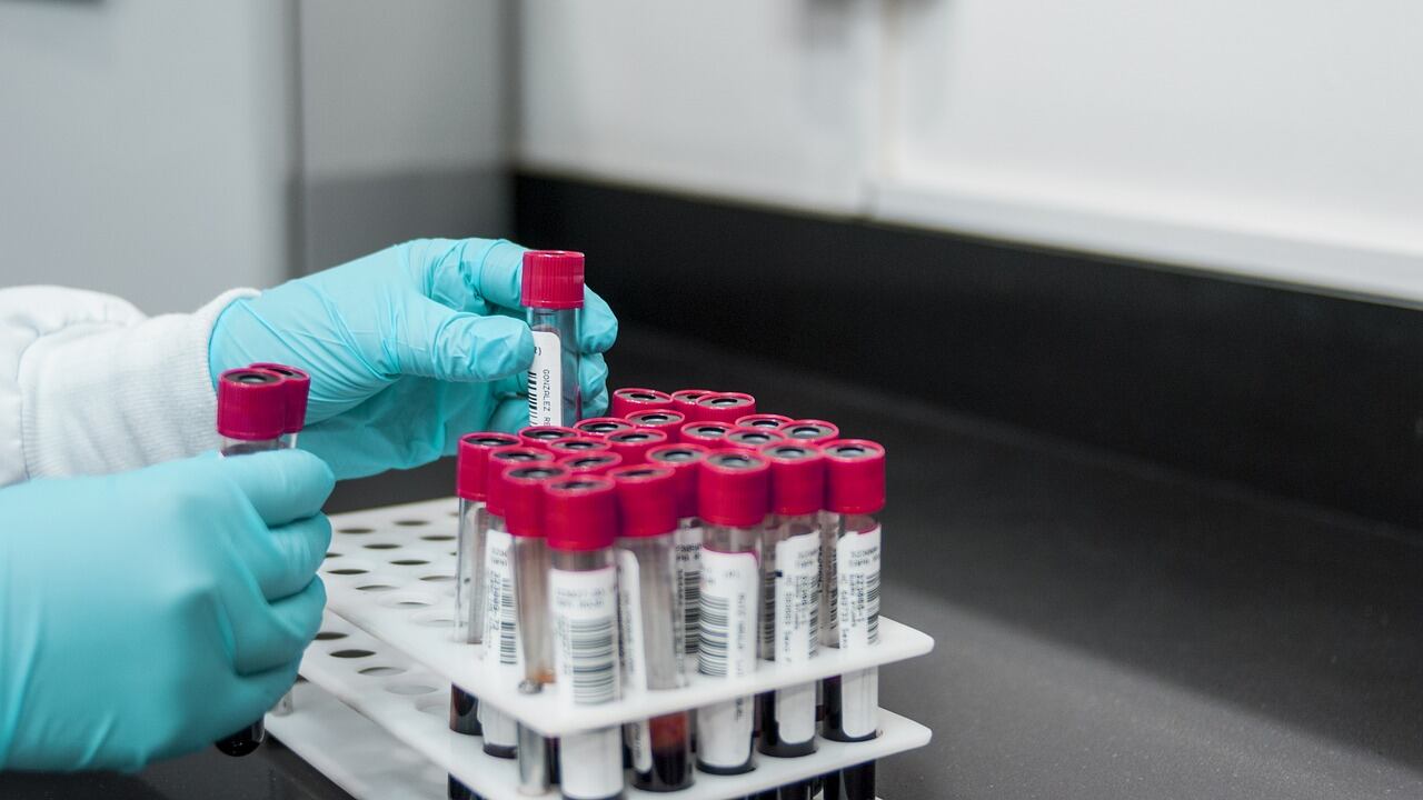 Cancro alla gola, un esame del sangue può prevederlo