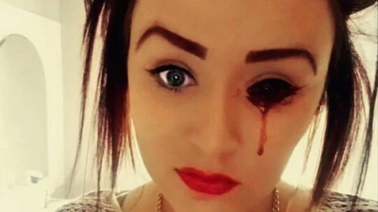 Ragazza perde sangue dagli occhi, ma la sua malattia è sconosciuta