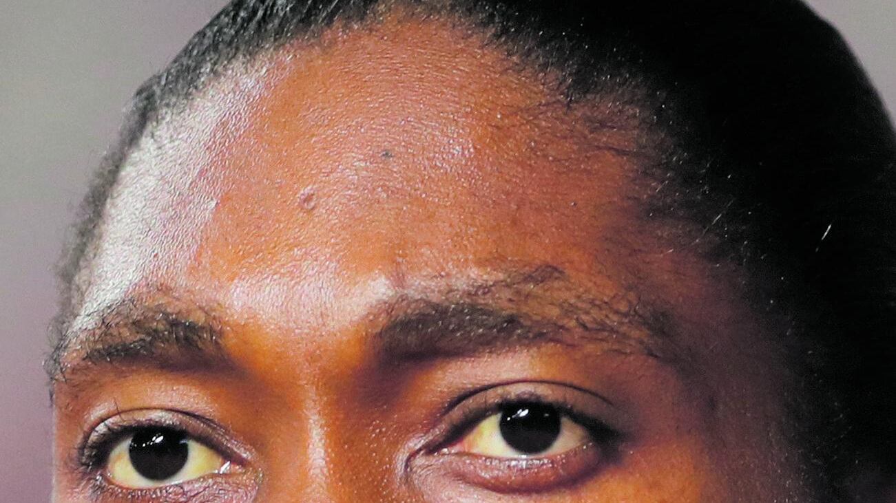 L'"intersessuale" Semenya e il caso dell'americana Thomas