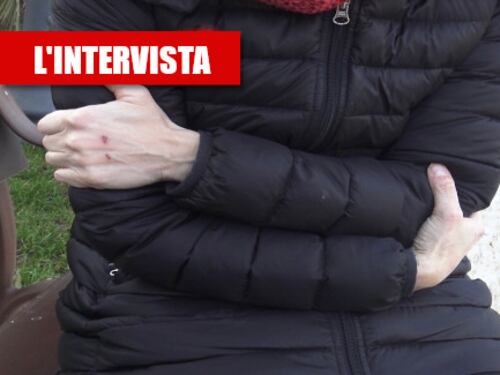 "Mi leccava la faccia, poi quel morso e con le mani...", il racconto choc della donna aggredita all'Esquilino
