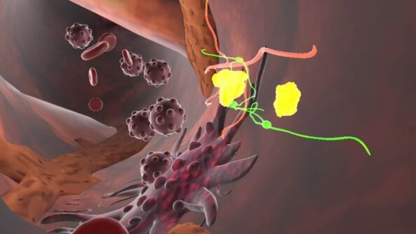 Viaggio dentro il corpo con la realtà aumentata