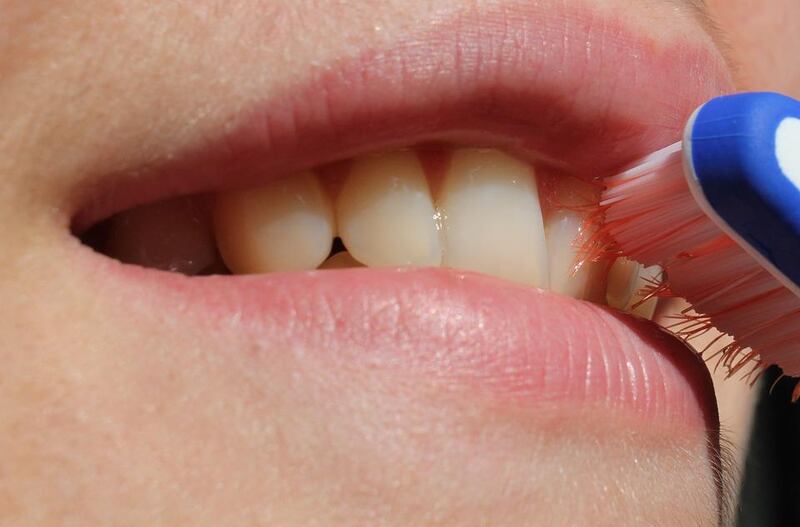 igiene dentale
