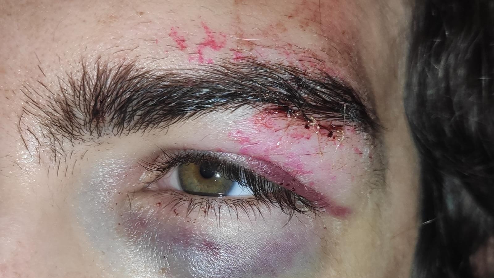 MagicLand, pestati a sangue mentre erano in fila