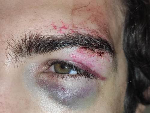 MagicLand, pestati a sangue mentre erano in fila