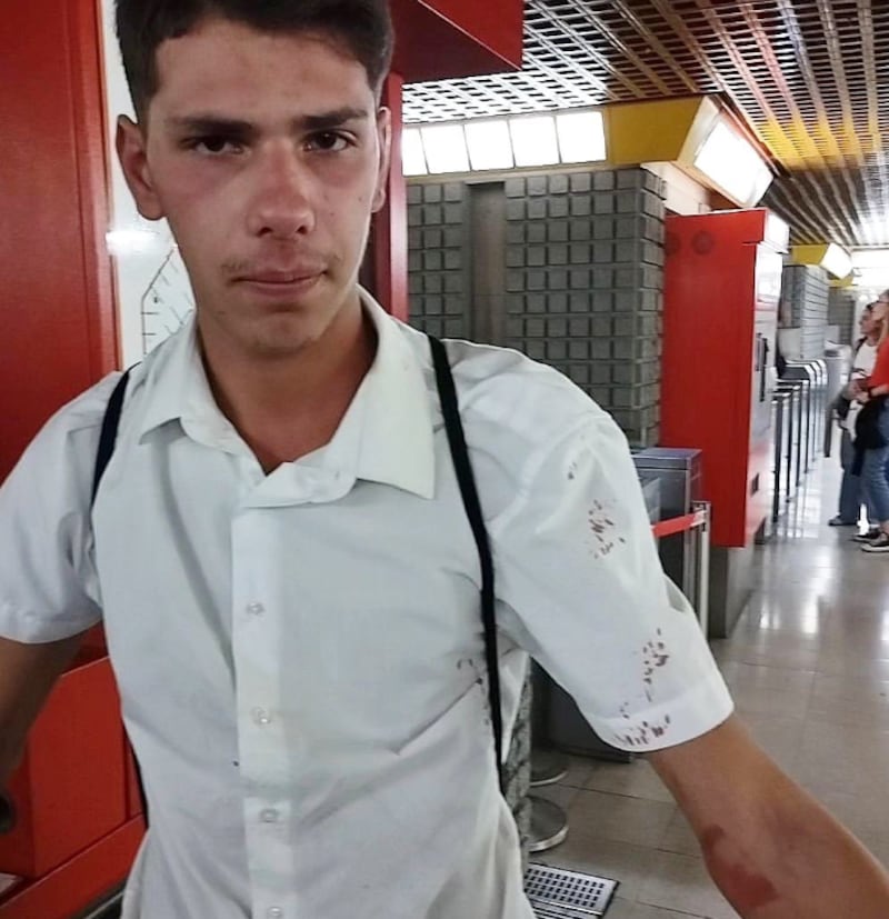 Ragazzo pestato a sangue in metropolitana dalle guardie del corpo di una borseggiatrice 2