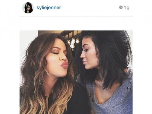 Khloe Kardashian conferma: "Questa è la verità sulle labbra di Kylie Jenner"