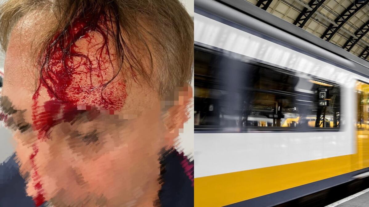 L'agente soccorre un migrante sul treno. Ma lui lo ferisce alla testa