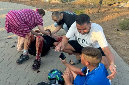 Le immagni della strage dei bambini nel Golan 4